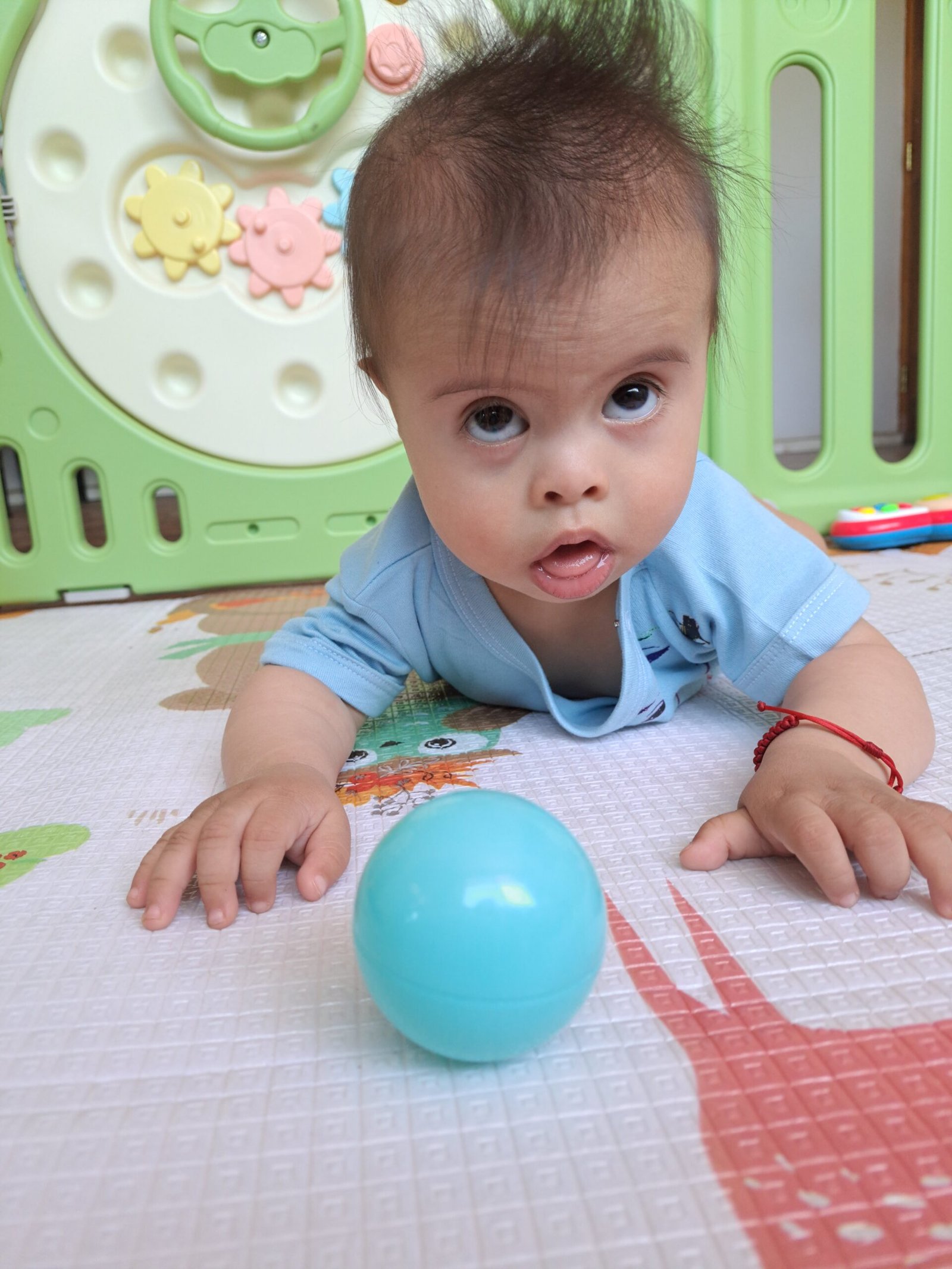 A joyful child with Down syndrome playing with a colorful ball, showcasing happiness and engagement in play.